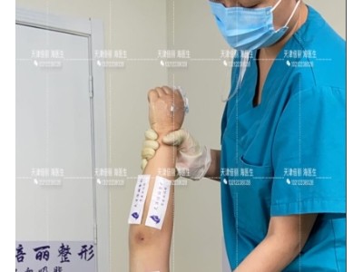 打造吸脂塑形减肥第一品牌