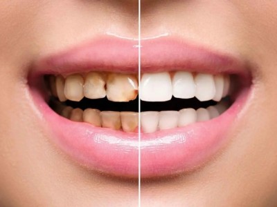 从"齿" 开始,嘉兴曙光口腔为你打造